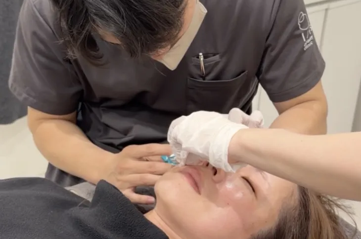 ボトックス注射の様子