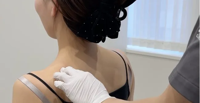 肩ボトックスの様子