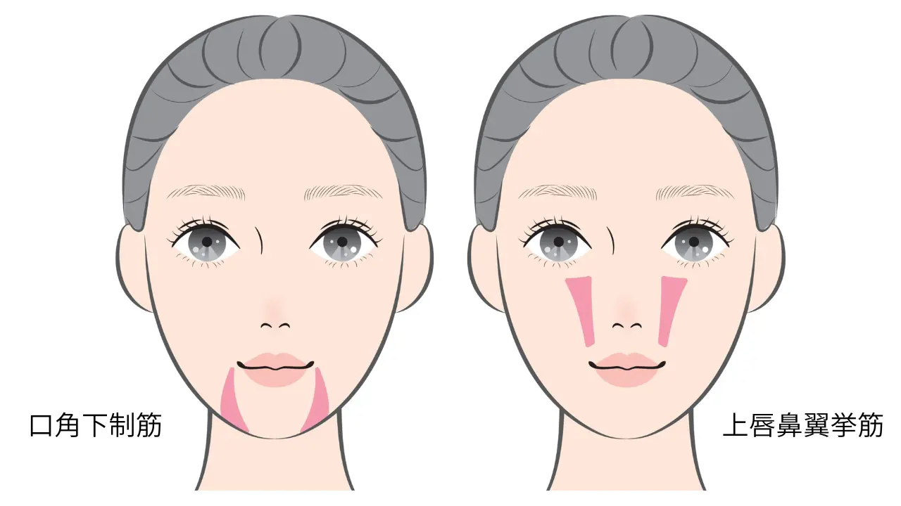口角下制筋と上唇鼻翼挙筋