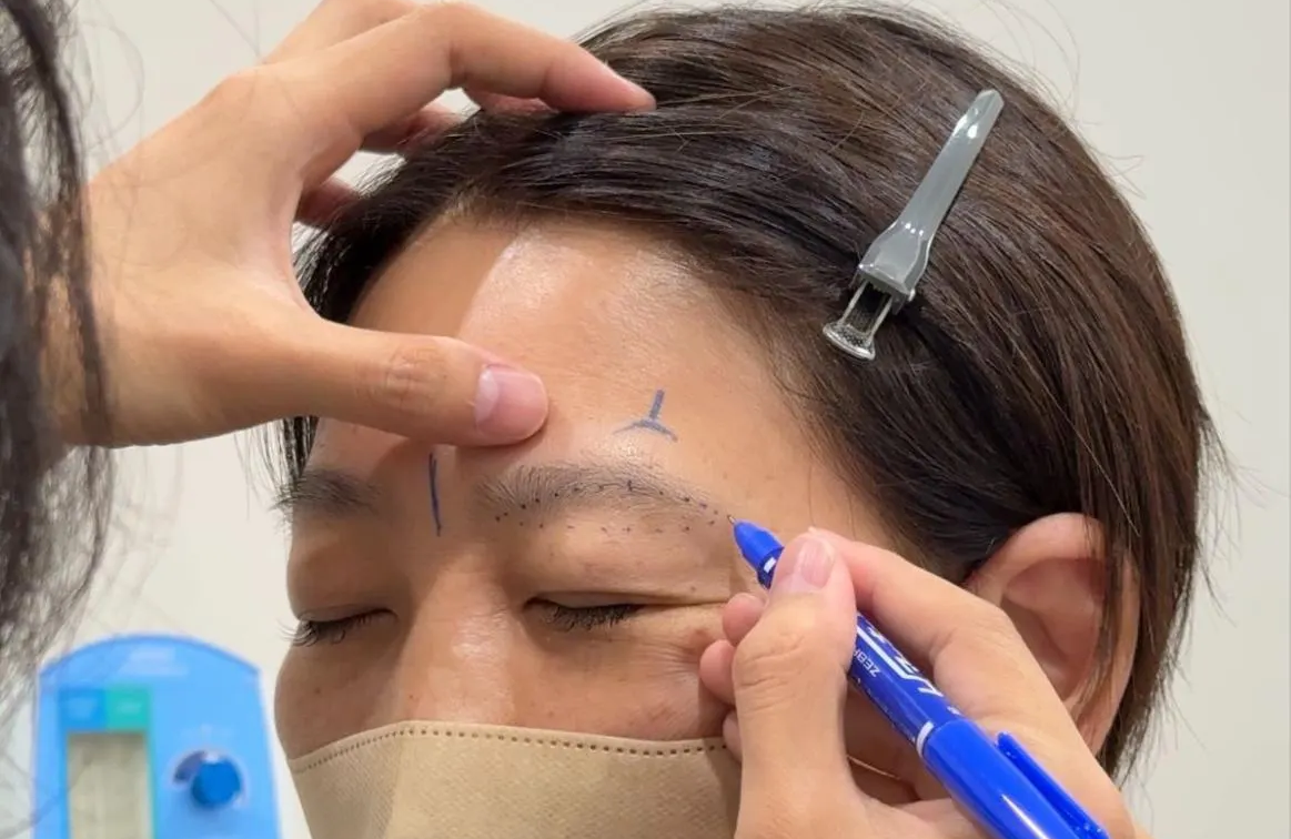 眉下切開のデザインの様子