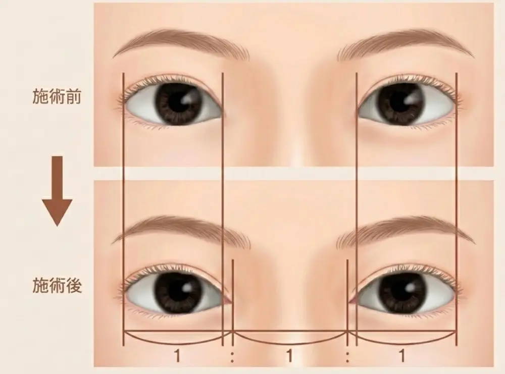 目の「1：1：1」のバランスを示すイラスト