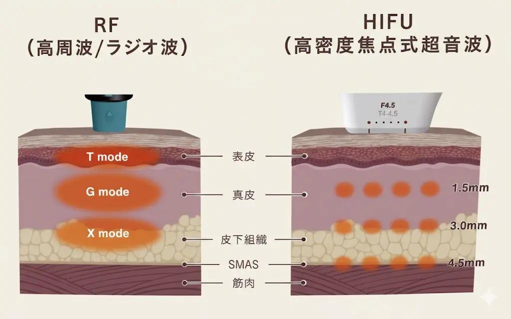RF・HIFUの説明図