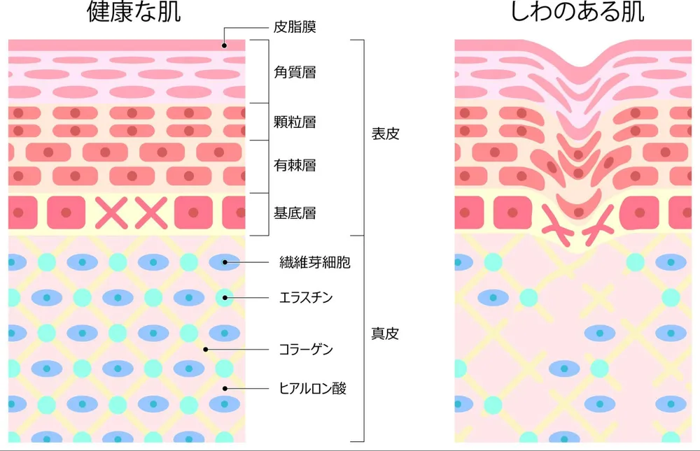 真皮層の線維芽細胞