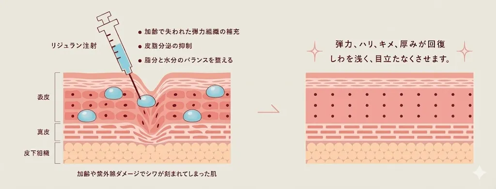 リジュラン（サーモン注射）の仕組み