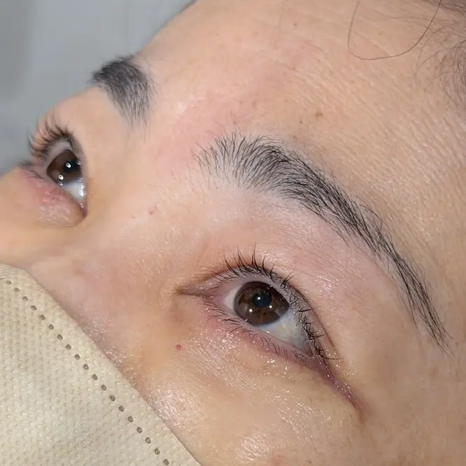 傷跡を極限まで目立たなくする、繊細な縫合