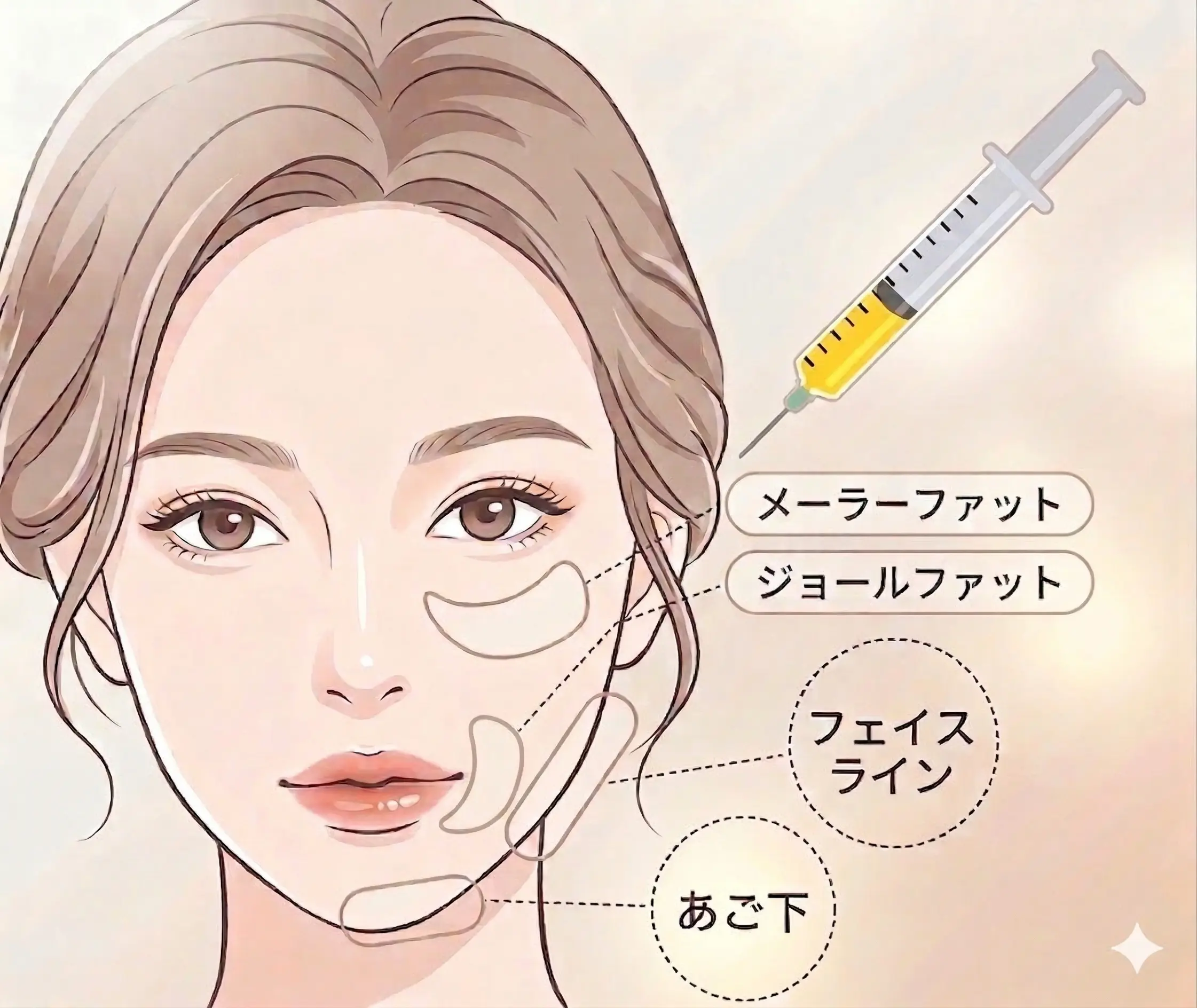 脂肪吸引注射　部位