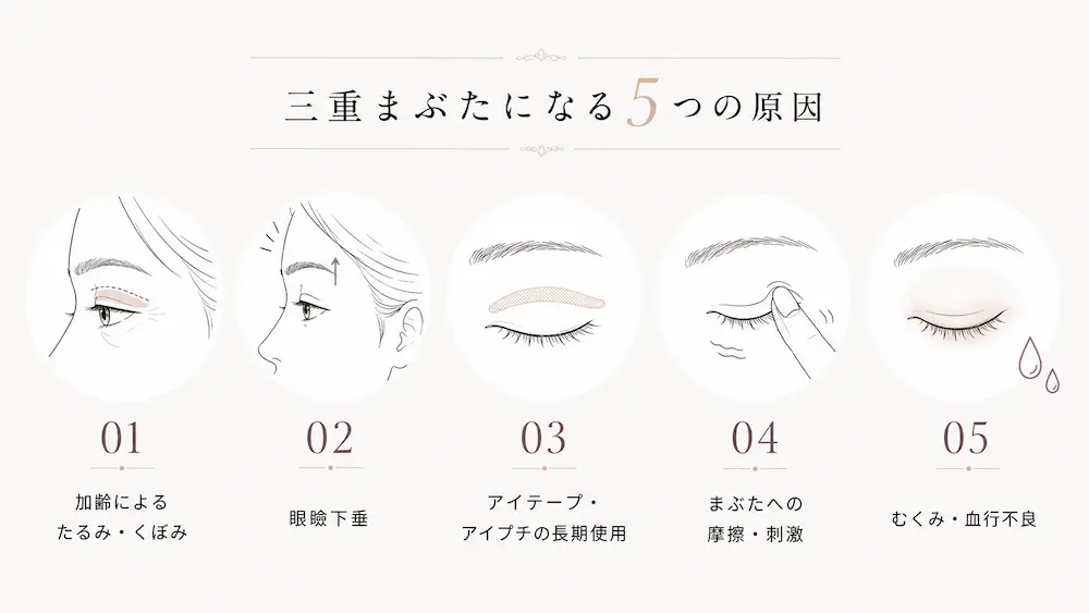 三重まぶたになる5つの原因