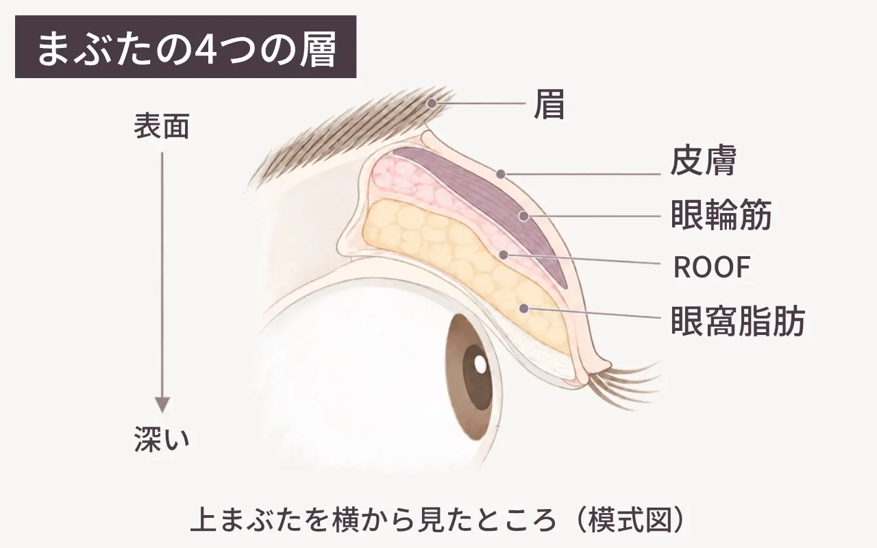 上まぶたの断面の模式図。表面から順に皮膚・眼輪筋・ROOF（眉の下の脂肪）・眼窩脂肪が重なる