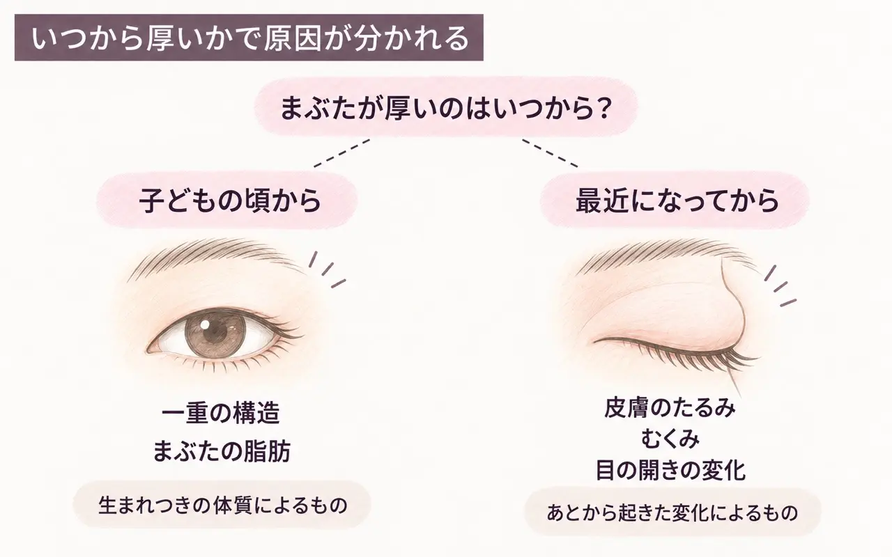 いつから厚いかで原因が分かれる図。子どもの頃からなら一重の構造やまぶたの脂肪、最近からなら皮膚のたるみ・むくみ・目の開きの変化